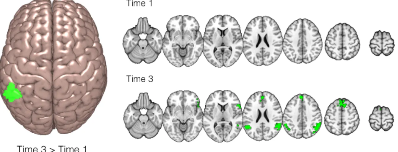 Figure 8. Brain activations in response to ungrammatical as compared to grammatical items for the group of  participants determined by the analysis of learning patterns in the behavioural data as showing the most  pronounced difference in scores on the AGL