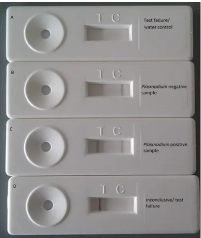 FIG 1 Examples of different test outcomes of the db-PCR-NALFIA. Controland test lines are absent