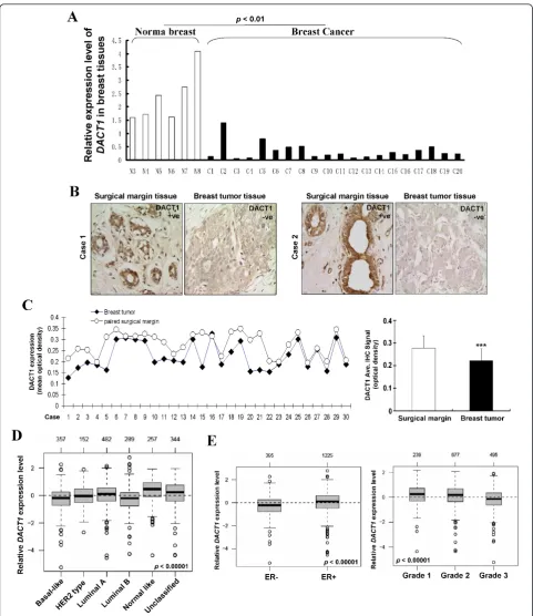 Figure 2 DACT1 was downregulated in primary breast tumors. (A) Analysis of DACT1 expression in normal breast tissues and primary breasttumors by using real-time PCR
