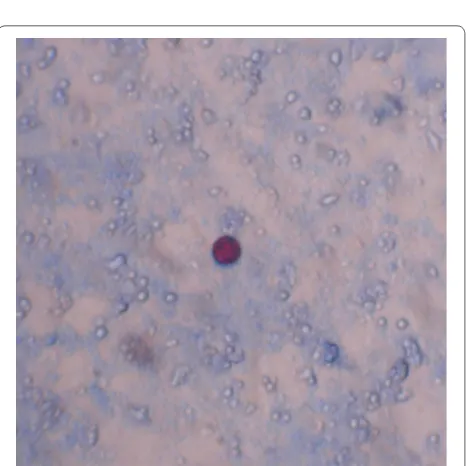Fig. 1 Photograph of oocyst of Cryptosporidium parvum (Ziehl–Neelsen staining at 100× magnification) found in this study