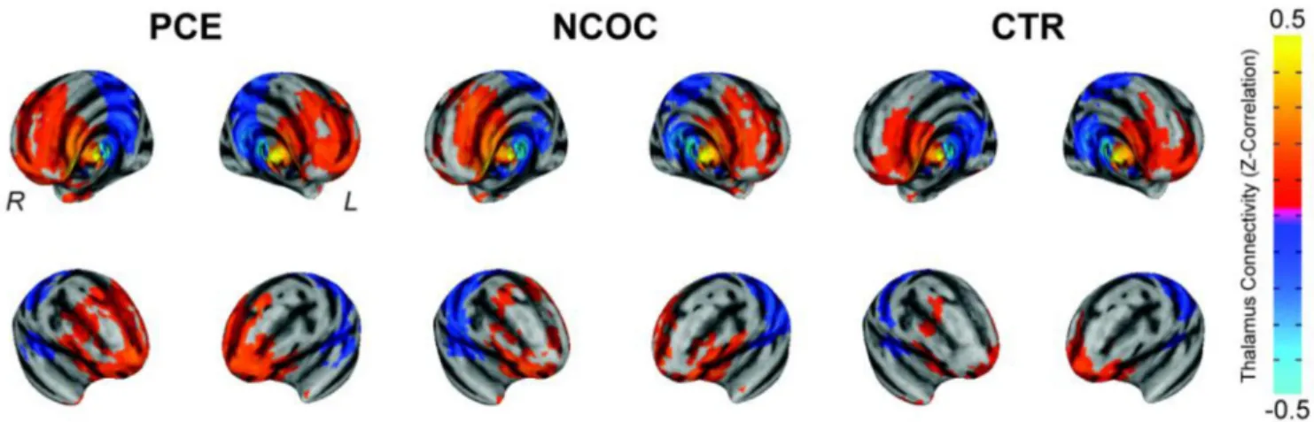 Figure 1. Visualization of thalamocortical functional connectivity segregation in neonates: 