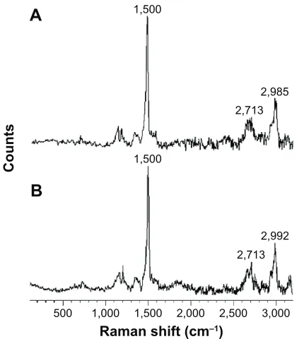 Figure 8 a comparison of hydroxyl radicals’ production.Notes: The production of hydroxyl radicals (calculated by the integrated areas of DMPO spin adduct) via Fenton reaction in comparison with the production of hydroxyl radicals (calculated by the integrated areas of DMPO spin adduct) via Fenton reaction in the presence of bulk form and nano Vitamin B12 obtained after 5-minute sonication.Abbreviation: DMPO, 5,5-dimethyl-1-pyrroline N-oxide.