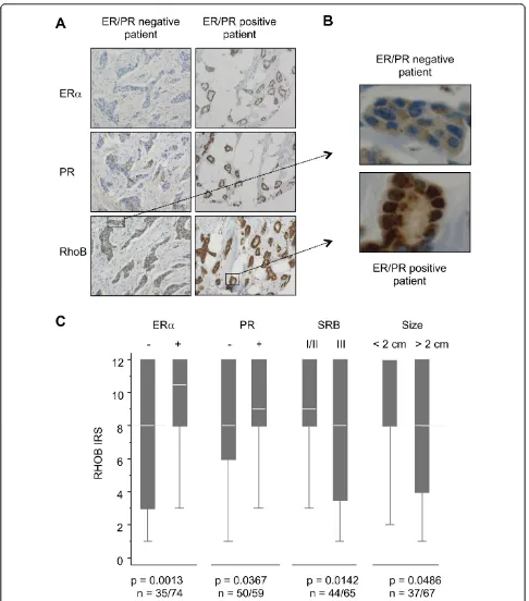 Figure 1 RhoB, estrogen receptor alpha and progesterone receptor expression in tumor samples of breast cancer patients(A) Immunohistochemistry staining shown for two patients, representative of both the estrogen receptor (ER)/progesterone receptor (PR)-neg