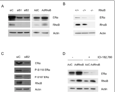 Figure 2 Regulation of estrogen receptor alpha expression by RhoB in MCF-7 cells and in vivo