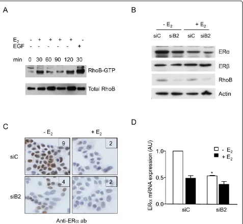Figure 3 RhoB activation and regulation of estrogen receptor alpha expression with/without estradiol in MCF-7 cellsdeprived of estradiol (Econditions, representative of two independent experiments