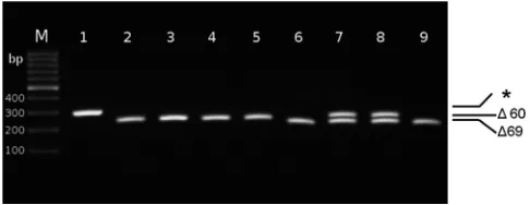 FIG 1 Typical agarose gel electrophoresis pattern of NA gene-speciﬁc RT-PCR products from duck and turkey clinical specimens, using internal primers(NA-F: 5TGGAACCAATTC-3turkey swabs, showing a 60-nucleotide deletion; lanes 6 to 9: representative lateturke