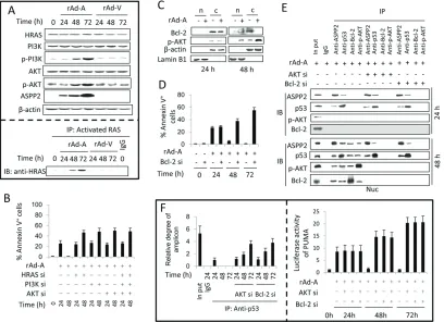 Figure 2: Activation of the HRAS/PI3K/AKT pathway inhibits ASPP2-induced apoptosis. (assay was used to detect the activation of the HRAS/PI3K/AKT pathway in HepG2 cells infected with rAd-ASPP2 (rAd-A) and rAd-Vector (rAd-V) for the indicated times