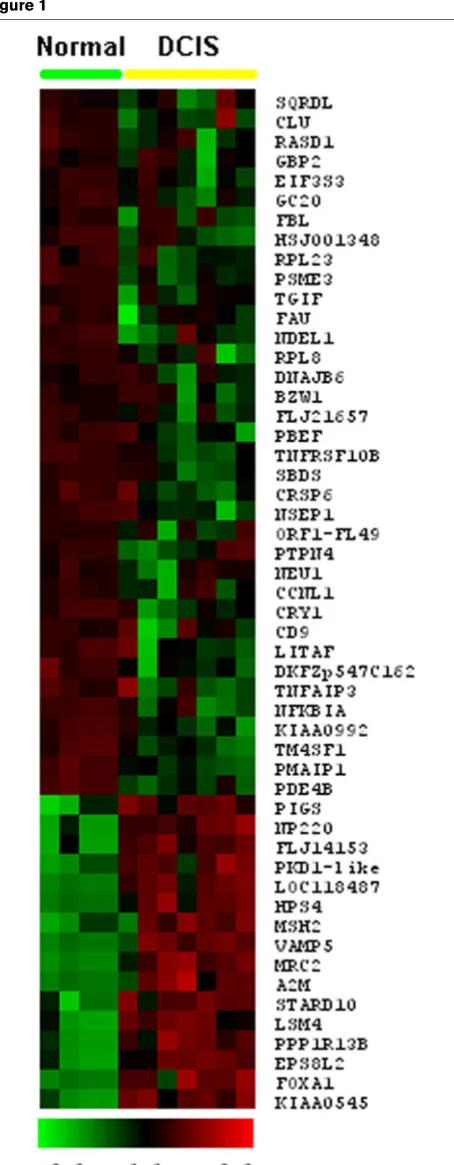 Figure 1As expected, we detected various ribosomal genes amongthe most abundant transcripts in all the breast SAGE librar-