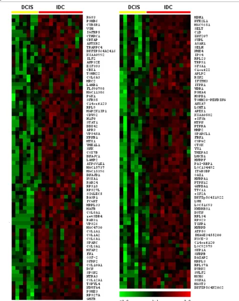 Figure 2Hierarchical clustering of the most commonly differentially expressed genes between ductal carcinoma (IDC) groups (Hierarchical clustering of the most commonly differentially expressed genes between ductal carcinoma P < 0.01)in situ in situ (DCIS) and invasive ductal carcinoma (DCIS) and invasive ductal carcinoma P 