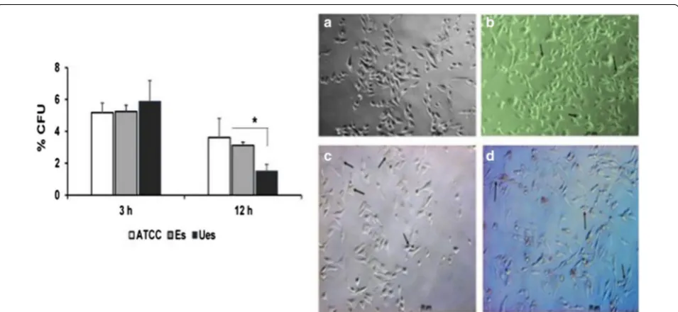 Fig. 3 Analysis of TLR2 mRNA expression in MG-63 cells after infected by E. faecalis ATCC 29212, encapsulated (Es), and uencapsulated (Ues) strains