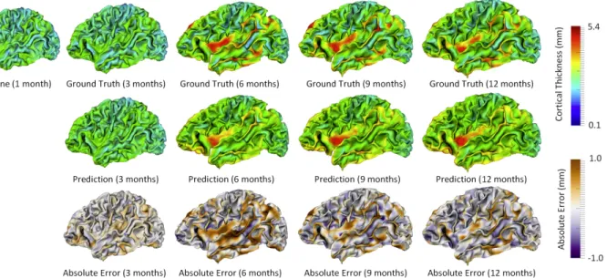 Figure 3.3. Prediction of the cortical thickness maps for a randomly selected subject