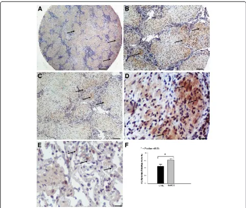 Figure 4 ING4 immunohistochemical staining in sarcoidosis lung samples. Representative immunohistochemical staining with monoclonalantibody against ING4 shows positively stained epithelioid cells within within granulomas (arrows) derived from sarcoidosis p