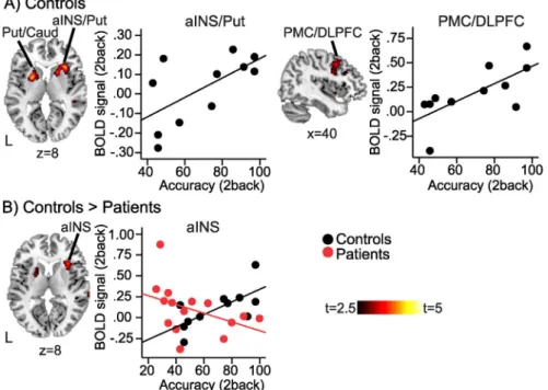 Fig. 3. Relationship between BOLD response and task performance. A) In controls, BOLD response during 2back was signiﬁcantly positively correlated with 2back task accuracy in right anterior insula (Freeman et al., 2011), bilateral putamen (Put), left cauda