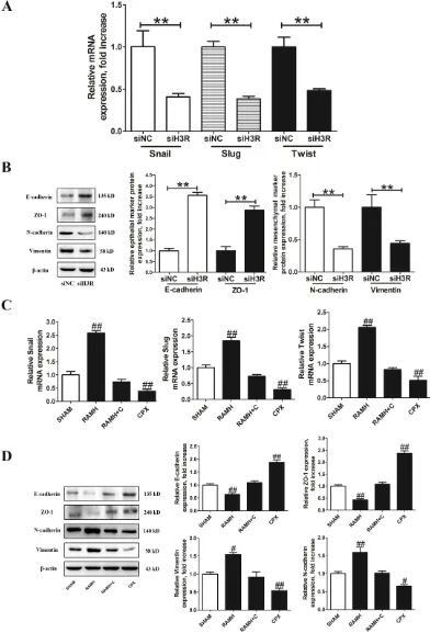 Figure 4: Inhibition of the H3R by the siRNA or CPX suppressed EMT progression in U87MG cells