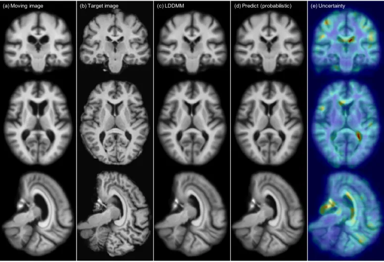 Figure 5: Atlas-to-image registration example. From left to right : (a): moving (atlas) image; (b): target image; (c): deformation from optimizing LDDMM energy; (d): deformation from using the mean of 50 samples from the probabilistic network with stride=1