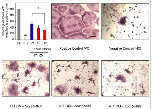 Figure 6 Loss of ABCC5 in breast cancer cells results in diminished osteoclast differentiation in vitro