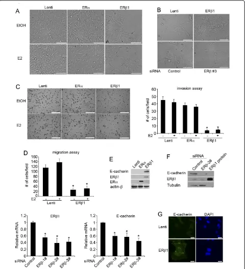 Figure 1 ERMDA-MB-231 cells following incubation with EtOH or 17b1 inhibits invasion and migration in breast cancer cells by regulating EMT