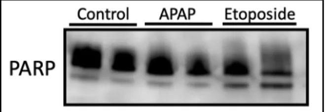 Figure 4. Characterization of PARP expression in APAP Etoposide treated SVneo cells. PARP  antibody detected endogenous levels of full length PARP1 as well as the large fragment of  PARP1 resulting from caspase cleavage indicating apoptosis in only the eto