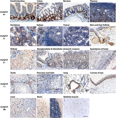 Figure 1: Mutp53 accumulation in morphologically normal multiple tissues in p53 R172H mice
