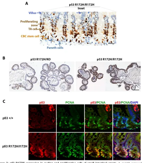 Figure 3: p53 R172H expression in cycling and proliferative cells of small intestinal crypts
