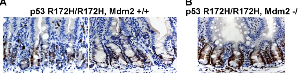 Figure 6: Increased mutp53 protein level in Mdm2 -/- mouse small intestine. A. p53 R172H/R172H, Mdm2+/+ and B
