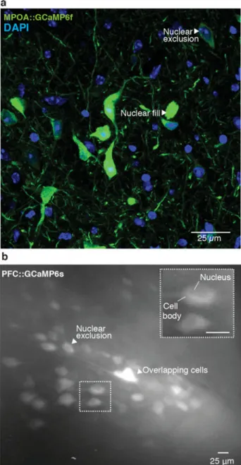 Figure 5. Example of healthy and unhealthy GCaMP expression