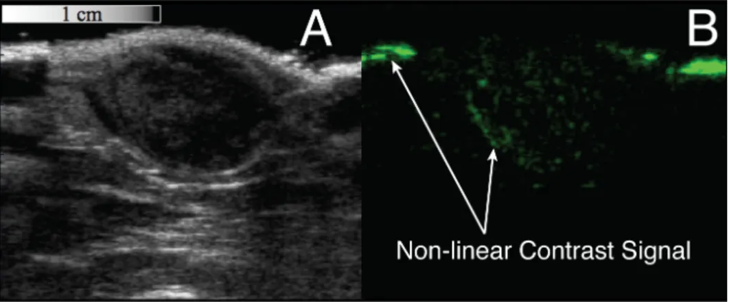 Figure 5.3: Examples of both b-mode and CPS images output from the Siemens Sequoia system