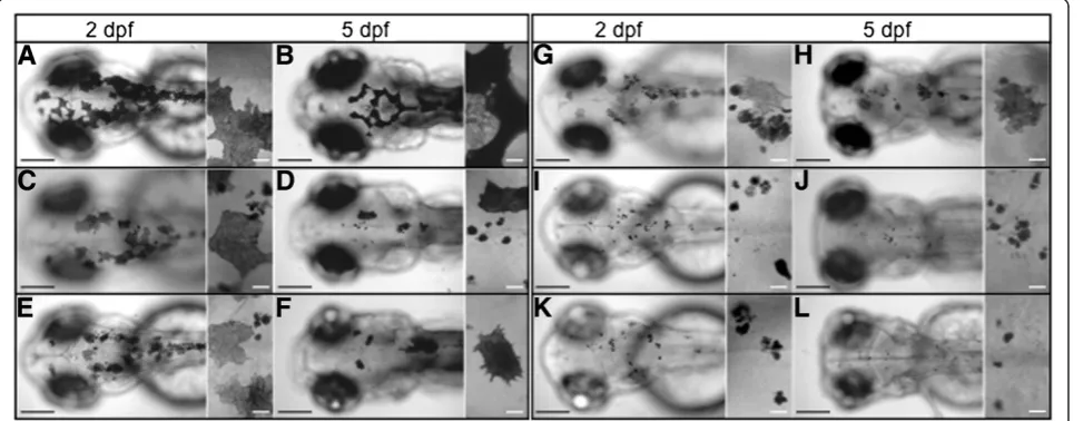 Figure 1 Dorsal views from five insertional zebrafish mutants in V-ATPase subunits.(genepigmentation