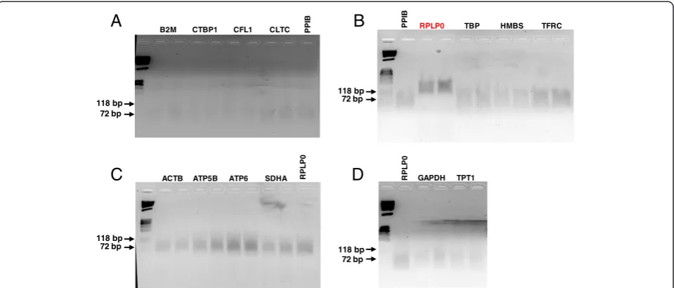 Figure 1 Primer validation. Each qPCR reaction mix was loaded in duplicate on 2% Agarose-1000 gels