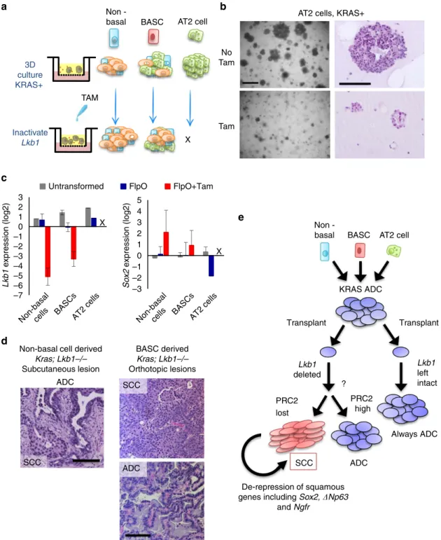 Figure 7 | Lkb1 deletion drives squamous transition of club cell- and BASC-derived KRAS þ populations