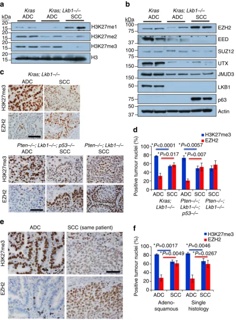 Figure 3 | Loss of histone H3 lysine 27 trimethylation accompanies SCC transition. (a) Western blotting analysis performed on whole-cell extracts from tumours of the indicated genotypes and histologies