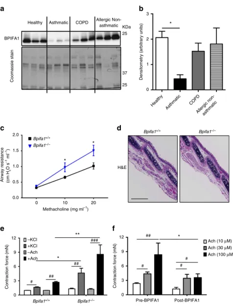 Figure 1 | BPIFA1 is diminished in asthmatic airways and is associated with airway hyperresponsiveness (AHR) in mice