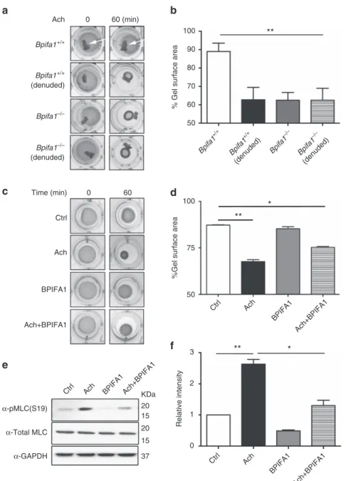 Figure 2 | BPIFA1 decreases airway smooth muscle (ASM) contractility by suppressing myosin light chain (MLC) phosphorylation