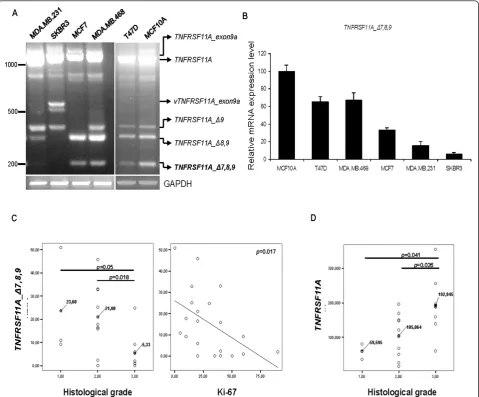 Figure 3 Expression of mRNA encoding tumor necrosis factor receptor superfamily, member 11a (TNFRSF11A, wild type receptoractivator of NF-kB, wt RANK), TNFRSF11A_Δ9 (RANK-a), TNFRSF11A_Δ8,9 (RANK-b) and TNFRSF11A_Δ7,8,9 (RANK-c) in breast cancer celllines 