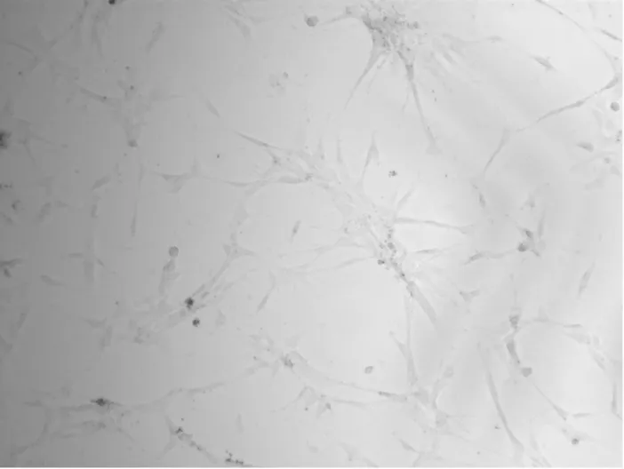 Figure	3	e:	Patient	B,	tooth	#17	cell	culture	 	 	 RNA	Extraction		 	 	 Each	cell	line	was	harvested	after	3	passages	in	order	to	extract	RNA	to	be	used	 in	genetic	expression	studies.	RNA	was	extracted	from	the	cell	cultures	using	TRIzol®	reagent	 and	fol