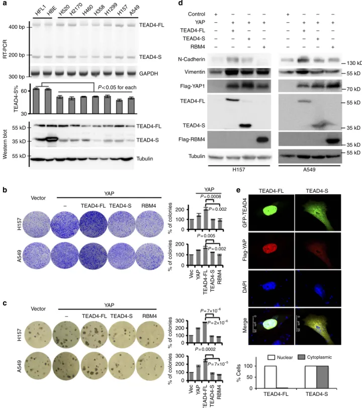 Figure 3 | TEAD4-S reduces cancer cell proliferation and EMT. (a) RNA levels (upper panel) and protein levels (lower panel) of TEAD4-S in various NSCLC lines and normal bronchial cells were measured by semi-quantitative RT–PCR and western blot