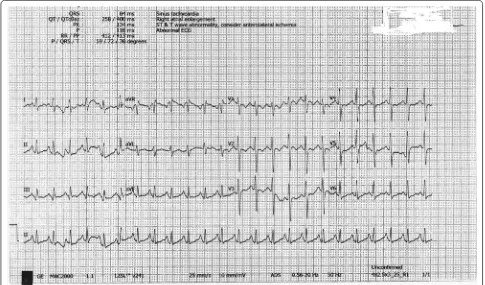 Fig. 2 Sinus tachycardia after giving  NaHCO3 with QRS duration 100 ms and ST/T wave abnormality