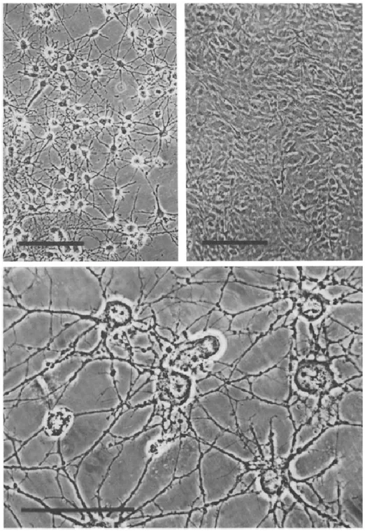 Figure 4 (McCarthy and de Vellis, 1980). Primary glial cultures. Phase contrast light micrographs of  primary oligodendroglial cell (left) and astroglial cell cultures (right), with higher magnification image  showing ramified oligodendroglial processes