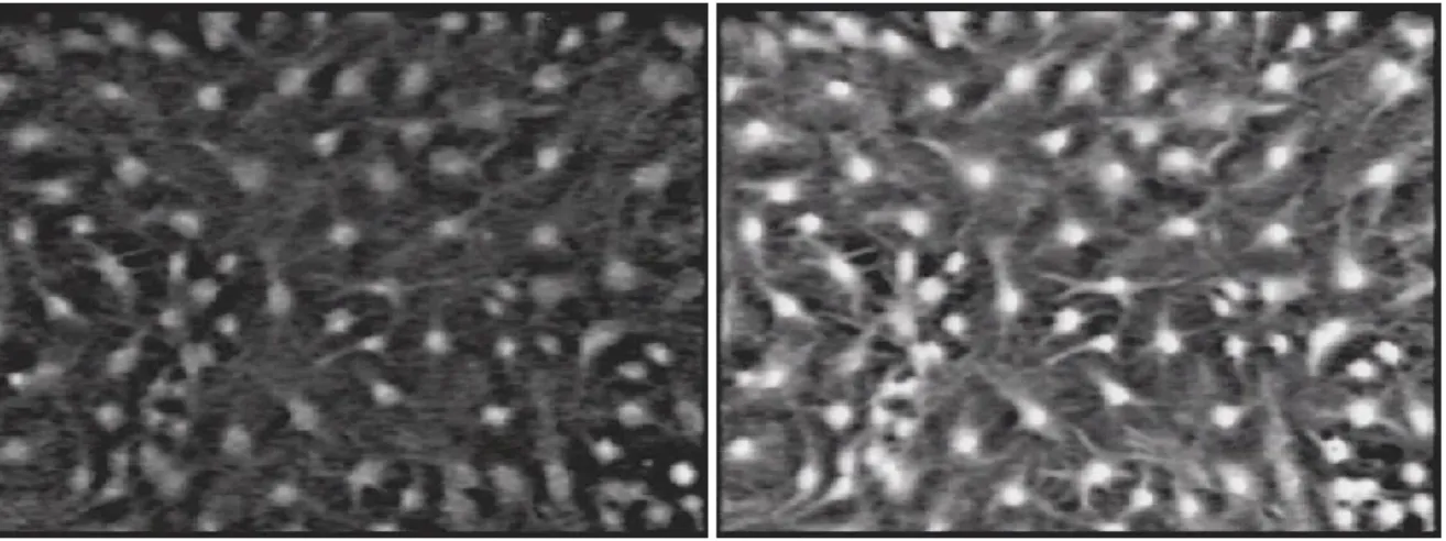 Figure 5 (Cornell-Bell et al., 1990). Intercellular Ca 2+  waves in cultured astrocytes