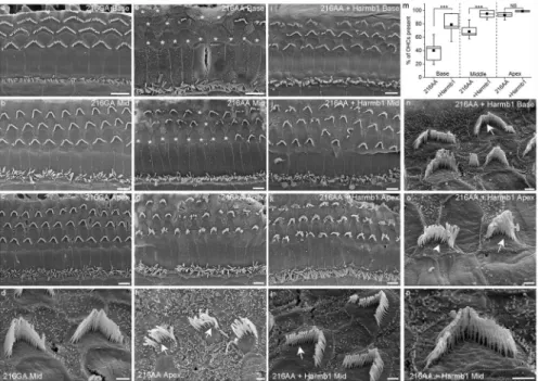 Figure 7. Scanning electron microscopy of the organ of Corti in mice injected with AAV2/