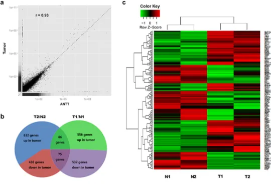 Figure 1: Schematic view of DEGs in GBC detected by RNA-Seq. a. Expression analysis of GBC tumor and ANTT samples