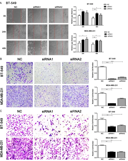 Figure 3. AFAP1-AS1 knockdown inhibited TNBC cell migration and invasion. (A) Wound healing assay (B) Migration assay (C) Invasion assay
