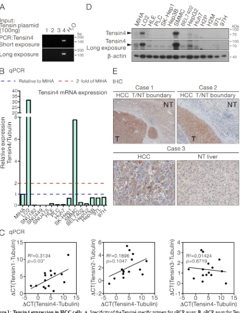 Figure 1: Tensin4 expression in HCC cells. A. Specificity of the Tensin4 specific primers for qPCR assay