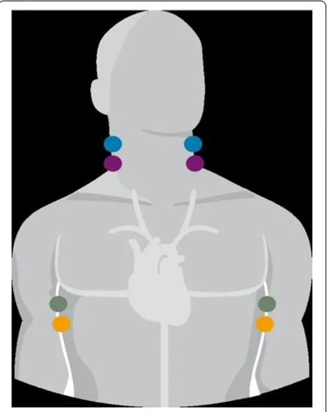 Figure 1 Electrode placement for impedancecardiography measurement.
