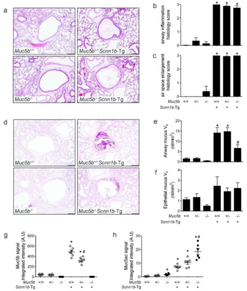 Figure 1. Mucus hyperconcentration/adhesion is necessary to produce bronchitic lung pathology,  but Muc5b deletion ameliorates airway mucus obstruction in Scnn1b-Tg mice