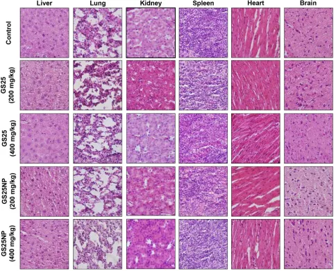 Figure 7: No host toxicity was caused by GS25 and GS25NP. CD-1 mice were orally treated with GS25 or GS25NP at a dose of 200 or 400 mg/kg/d for 7 days