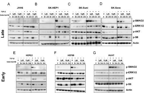 Figure 2: Effects of galunisertib on canonical and noncanonical TGF-β signalling. Protein expression was evaluated by Western blot after cell treatment with 1 and 10 µM galunisertib with or without 5 ng/mL TGF-β; JHH6 A