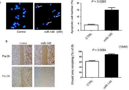 Figure 2: Exogenous miR-145 induces apoptosis in and inhibits cell migration of 253J B-V cells