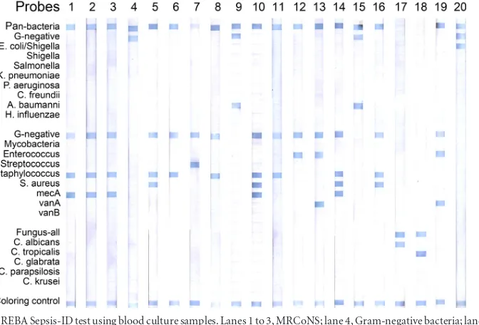 FIG 2 Typical results of the REBA Sepsis-ID test using reference strains. All Gram-negative bacteria, Gram-positive bacteria, and fungi show strong speciﬁchybridization signals at the positions of the corresponding probes