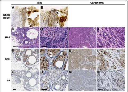 Figure 4 Histopathological analyses of the mammary gland carcinomas developed in STAT1magnification of the corresponding left panels